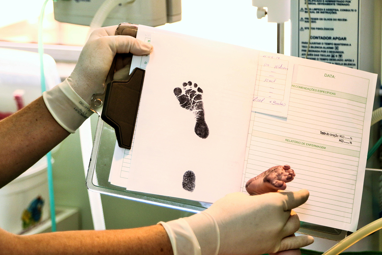 Photograph of baby's footprint on hospital chart.